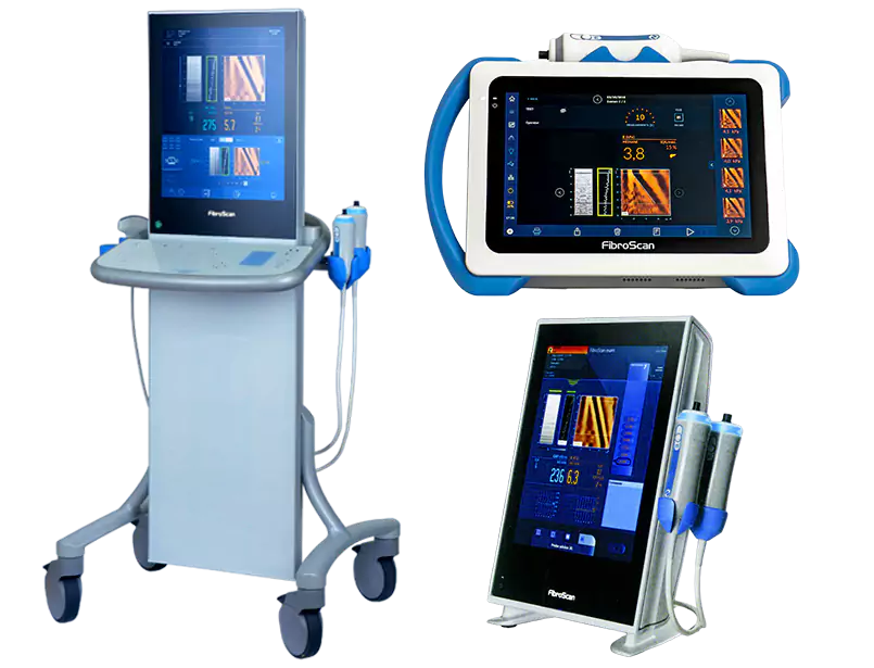 FibroScan